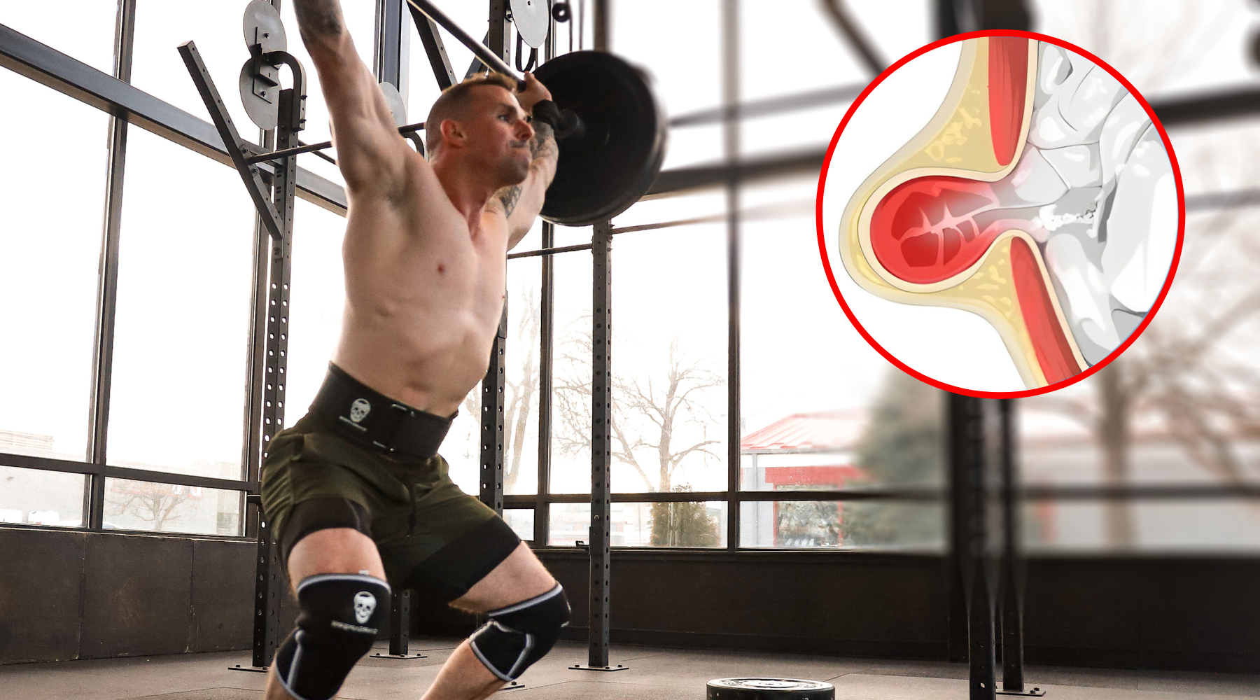 Weight online belt calisthenics